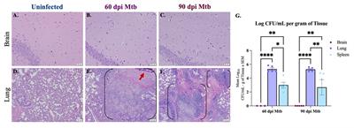 Gliosis, misfolded protein aggregation, and neuronal loss in a guinea pig model of pulmonary tuberculosis